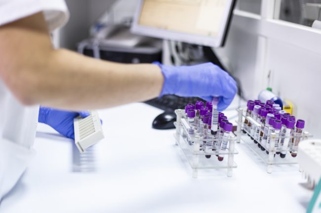Chemioterapia e digiuno studio “anti business e anti bufala” del San Matteo