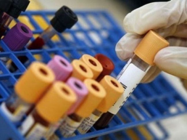 Epidemia legionella: tutto da rifare