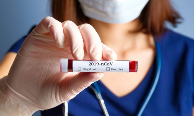 Coronavirus, 128 nuovi positivi in Lombardia. Nel Mantovano + 4 positivi