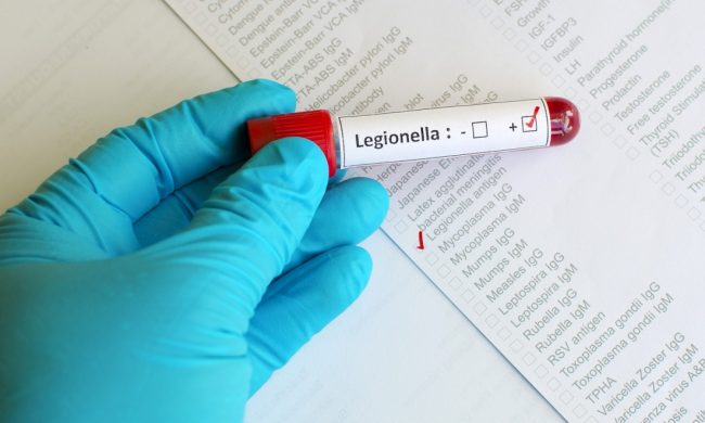 Legionella, 10 casi in provincia di Mantova: come difendersi dall’infezione