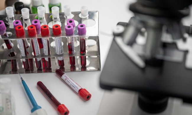 Conclusa la sperimentazione col plasma iperimmune, ora la palla passa a una commissione “segreta”