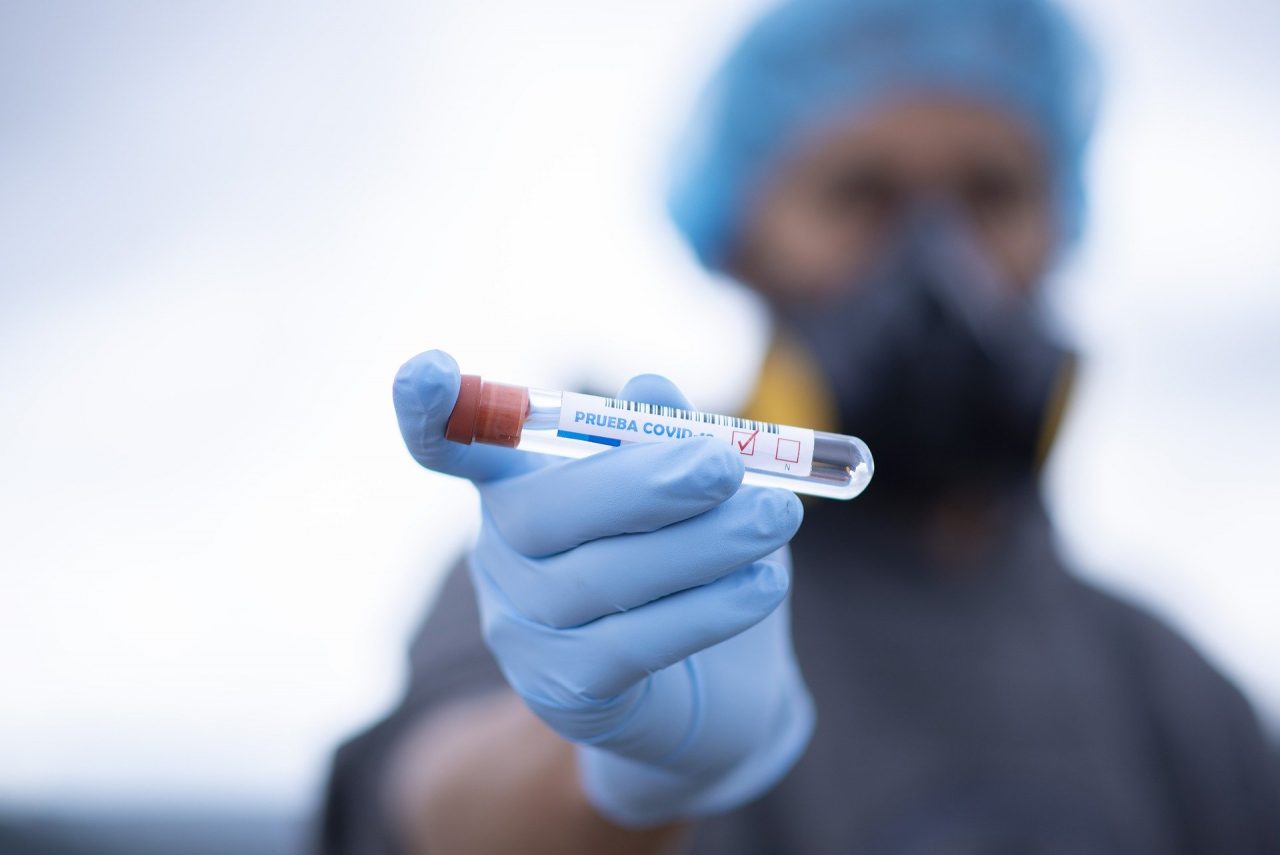 Coronavirus, scendono ancora le terapie intensive: a Mantova e provincia +3 positivi