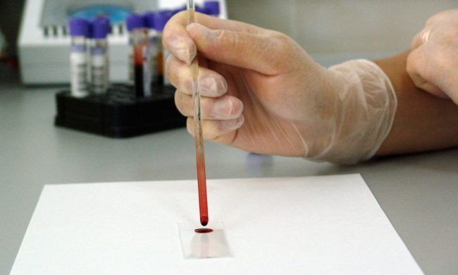 Lo studio mantovano conferma: meno rischio di ammalarsi di Covid per i soggetti di gruppo 0