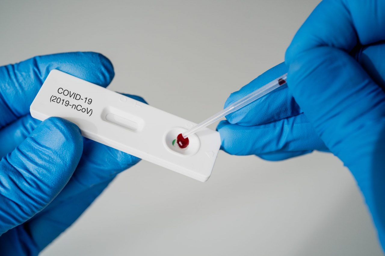Finito lo stato d’emergenza i tamponi a prezzi calmierati restano