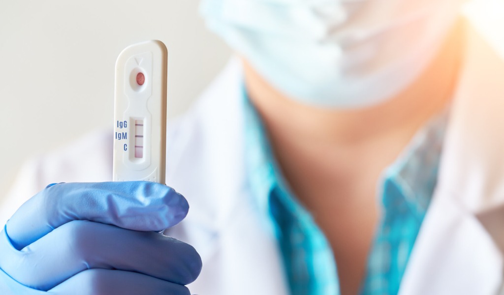 Processati dall’Asst Mantova oltre 6mila tamponi a settimana