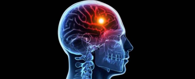 Riabilitazione cognitiva a domicilio dopo l’ictus, parte il progetto nel Mantovano
